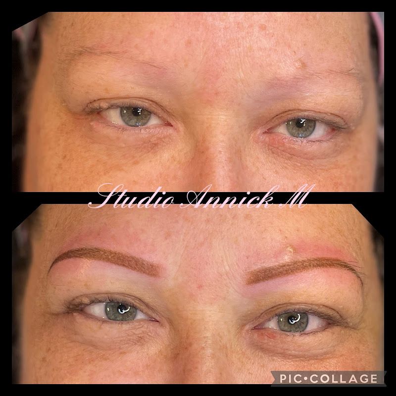 Chez Facial